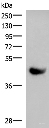 Western blot analysis of Human plasma solution using KIR2DL5A Polyclonal Antibody at dilution of 1:1000