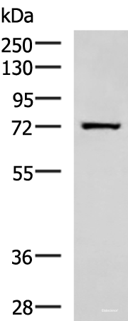 Western blot analysis of Human fetal liver tissue lysate using SHTN1 Polyclonal Antibody at dilution of 1:600