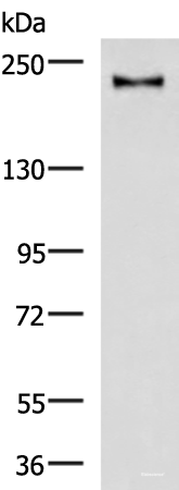 Western blot analysis of Mouse brain tissue lysate using KIF21B Polyclonal Antibody at dilution of 1:1000