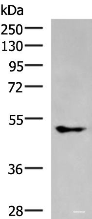 Western blot analysis of A549 cell lysate using KCNJ2 Polyclonal Antibody at dilution of 1:550