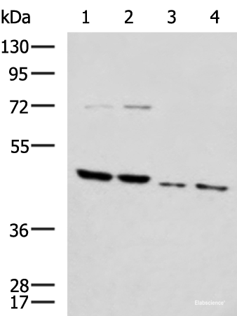 Western blot analysis of Rat brain tissue Mouse brain tissue Raji and 231 cell lysates using HTRA2 Polyclonal Antibody at dilution of 1:1000