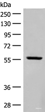 Western blot analysis of Mouse heart tissue lysate using BAG3 Polyclonal Antibody at dilution of 1:250