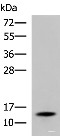 Western blot analysis of Mouse serum using TTR Polyclonal Antibody at dilution of 1:600