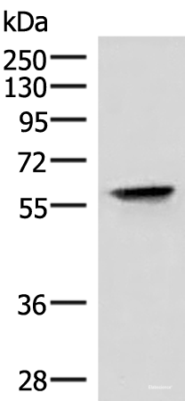 Western blot analysis of Hela cell lysate using VIM Polyclonal Antibody at dilution of 1:4000