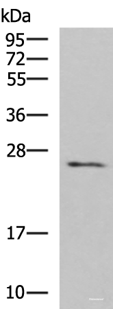 Western blot analysis of Human fetal brain tissue lysate using CLEC4D Polyclonal Antibody at dilution of 1:700