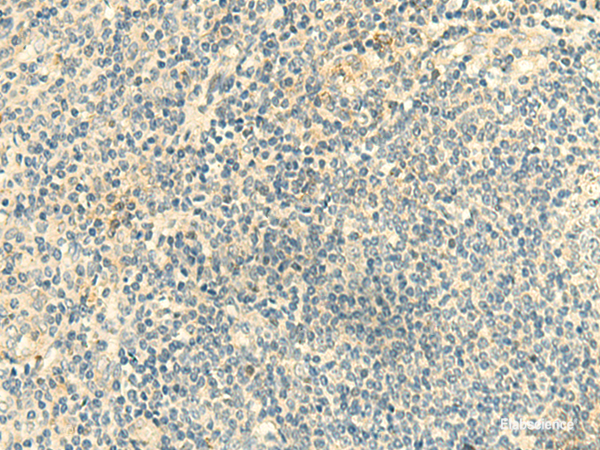 Immunohistochemistry of paraffin-embedded Human tonsil tissue using CLEC10A Polyclonal Antibody at dilution of 1:50(×200)