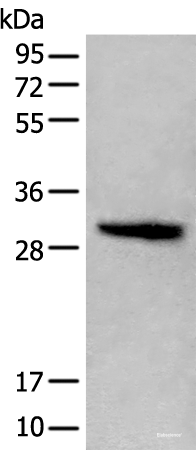 Western blot analysis of Jurkat cell lysate using HIST1H1C Polyclonal Antibody at dilution of 1:400