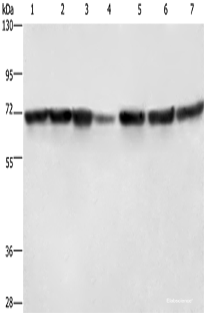 Western blot analysis of Hela cells HT29 cells human fetal liver tissue Human testis tissue 231 cells K562 cells human bladder transitional cell carcinoma tissue using LMNB1 Polyclonal Antibody at dilution of 1:750