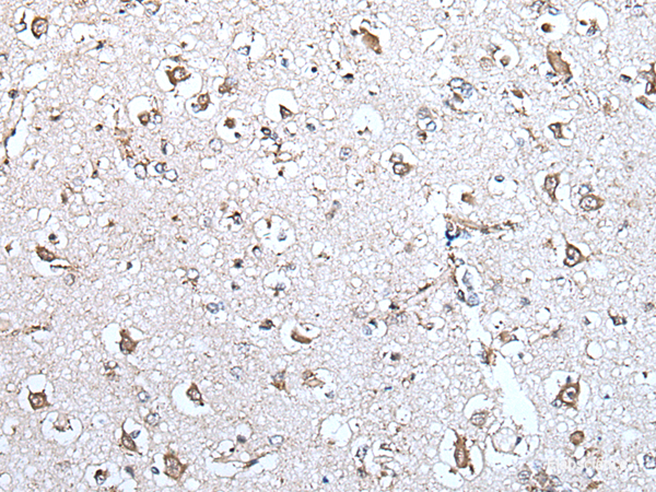 Immunohistochemistry of paraffin-embedded Human brain tissue using MCM10 Polyclonal Antibody at dilution of 1:45(×200)