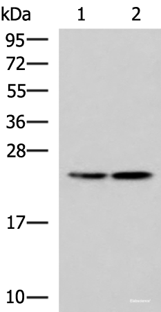 Western blot analysis of A549 and A172 cell lysates using RGS2 Polyclonal Antibody at dilution of 1:1350