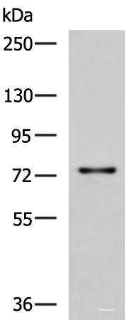 Western blot analysis of Rat liver tissue lysate using TGFBI Polyclonal Antibody at dilution of 1:850