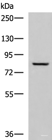 Western blot analysis of Human tongue tissue lysate using TGM3 Polyclonal Antibody at dilution of 1:800