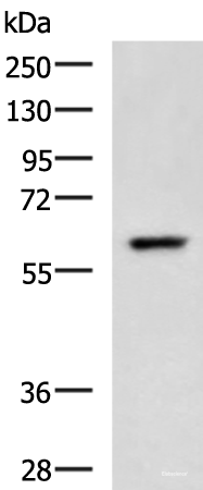 Western blot analysis of A549 cell lysate using TERF1 Polyclonal Antibody at dilution of 1:400