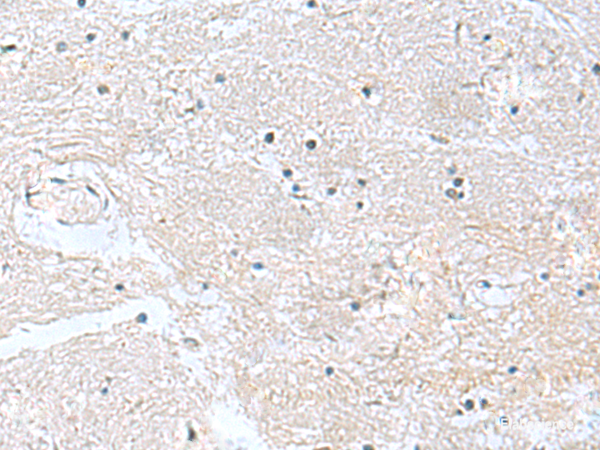 Immunohistochemistry of paraffin-embedded Human brain tissue using CACNB1 Polyclonal Antibody at dilution of 1:100(×200)