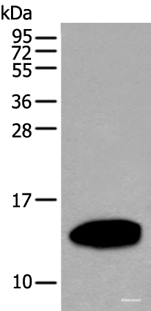 Western blot analysis of Human pancreas tissue lysate using REG1A Polyclonal Antibody at dilution of 1:500