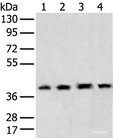 Western blot analysis of 231 cell Human testis tissue Hela and Hepg2 cell using TBP Polyclonal Antibody at dilution of 1:400