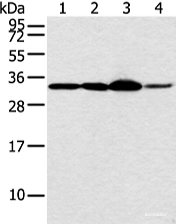 Western blot analysis of Hela and PC3 cell 231 cell and human esophagus cancer tissue using MED6 Polyclonal Antibody at dilution of 1:400