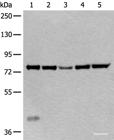 Western blot analysis of Mouse liver tissue Hela cell Human testis tissue Jurkat and HEPG2 cell lysates using ATF6B Polyclonal Antibody at dilution of 1:300