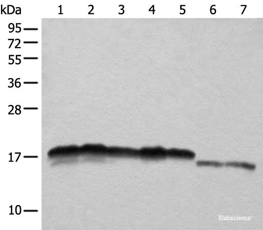Western blot analysis of Hela HEPG2 A431 K562 and 231 cell Mouse liver tissue and Mouse brain tissue lysates using NDUFB11 Polyclonal Antibody at dilution of 1:1000