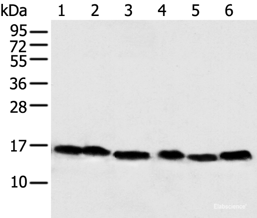 Western blot analysis of 293T Hela PC-3 Lncap and 231 cell Human fetal muscle tissue using NDUFB6 Polyclonal Antibody at dilution of 1:500