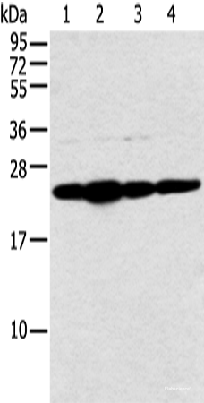 Western blot analysis of Hela cell and human fetal liver tissue A549 and Jurkat cell using NDUFB9 Polyclonal Antibody at dilution of 1:400