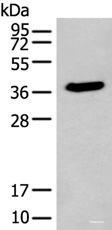 Western blot analysis of HEPG2 cell lysate using ACBD4 Polyclonal Antibody at dilution of 1:400