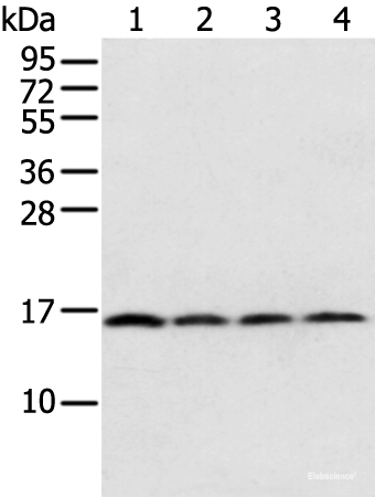 Western blot analysis of 231 Hela K562 cell and Human bladder carcinoma tissue using MRPS18C Polyclonal Antibody at dilution of 1:800