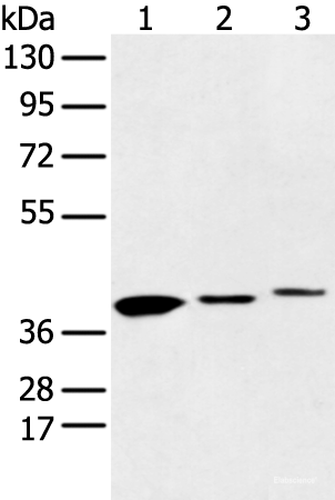 Western blot analysis of 231 cell Human fetal liver and Human fetal brain tissue using MAT2B Polyclonal Antibody at dilution of 1:500