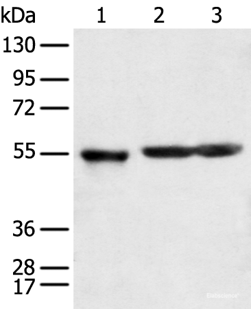 Western blot analysis of Human cerebrum tissue rat brain tissue and Mouse brain tissue using KCTD16 Polyclonal Antibody at dilution of 1:350