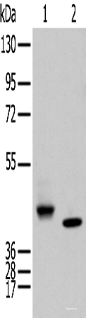 Western blot analysis of Human fetal brain tissue and Human kidney tissue using IDO2 Polyclonal Antibody at dilution of 1:450