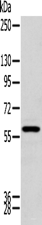 Western blot analysis of Human kidney tissue using ZNF248 Polyclonal Antibody at dilution of 1:200