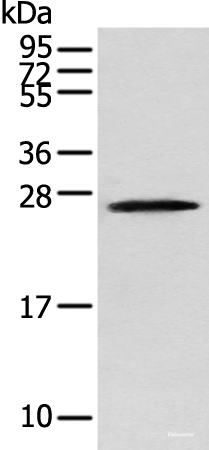 Western blot analysis of Human fetal brain tissue using TPPP Polyclonal Antibody at dilution of 1:250