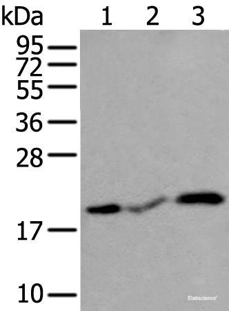 Western blot analysis of Human heart tissue Rat heart tissue and Mouse heart tissue lysates using CSRP3 Polyclonal Antibody at dilution of 1:400