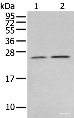 Western blot analysis of Human fetal brain tissue 231 cell using RAB11A Polyclonal Antibody at dilution of 1:400