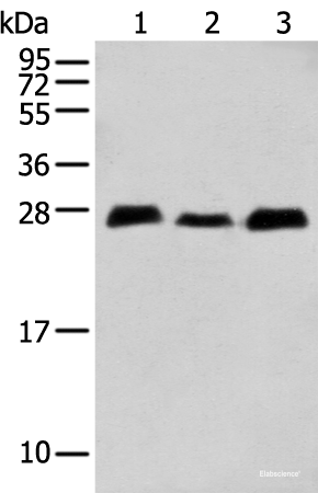 Western blot analysis of Human fetal brain tissue Human cerebrum tissue Mouse brain tissue using MOB4 Polyclonal Antibody at dilution of 1:400