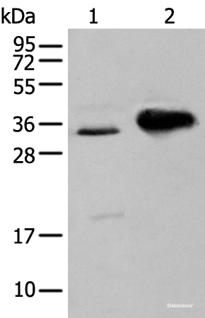 Western blot analysis of TM4 cell and Mouse brain tissue using ATP6V1E2 Polyclonal Antibody at dilution of 1:400