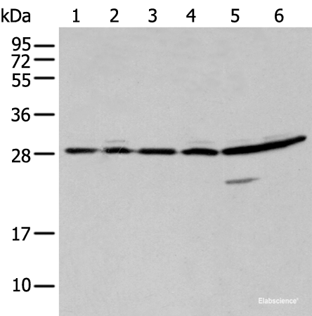 Western blot analysis of 293T A549 and Hela cell using SFN Polyclonal Antibody at dilution of 1:250