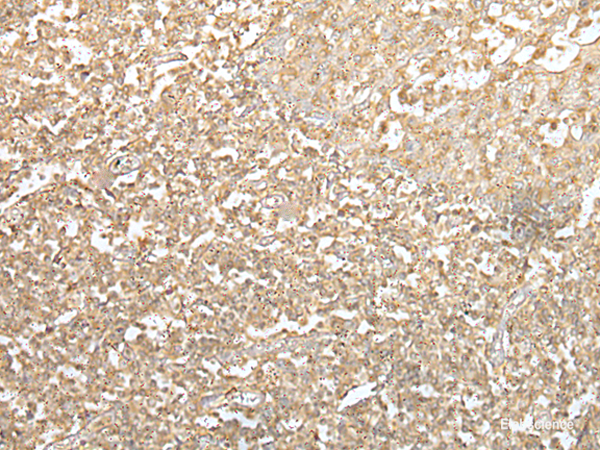 Immunohistochemistry of paraffin-embedded Human tonsil tissue using SPIC Polyclonal Antibody at dilution of 1:55(×200)