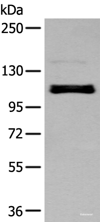 Western blot analysis of A549 cell using ZNF281 Polyclonal Antibody at dilution of 1:250