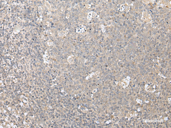 Immunohistochemistry of paraffin-embedded Human tonsil tissue using ZFYVE1 Polyclonal Antibody at dilution of 1:40(×200)