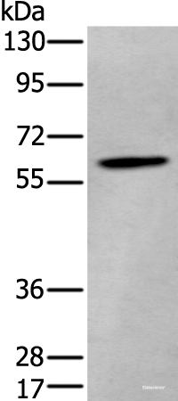 Western blot analysis of Human cerebrum tissue lysate using ZKSCAN1 Polyclonal Antibody at dilution of 1:400