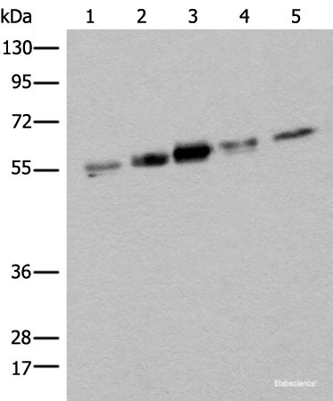 Western blot analysis of Hela HEPG2 231 A431 and Jurkat cell lysates using ZPR1 Polyclonal Antibody at dilution of 1:400