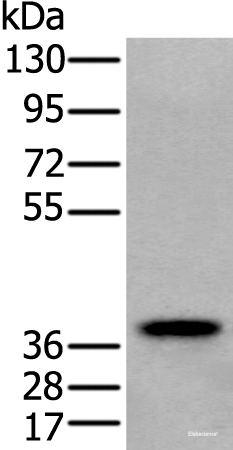 Western blot analysis of Human testis tissue lysate using ZPBP Polyclonal Antibody at dilution of 1:250