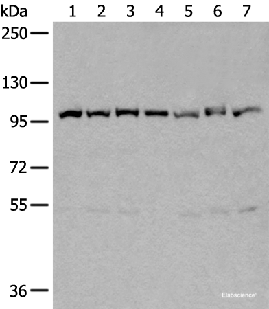 Western blot analysis of 231 Hela A549 A431 HEPG2 Jurkat and K562 cell lysates using VCP Polyclonal Antibody at dilution of 1:400