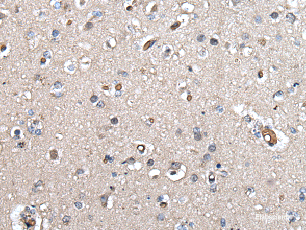 Immunohistochemistry of paraffin-embedded Human brain tissue using UMPS Polyclonal Antibody at dilution of 1:40(×200)