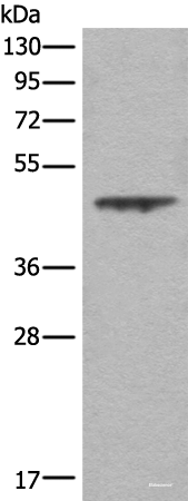 Western blot analysis of A431 cell lysate using ASS1 Polyclonal Antibody at dilution of 1:350