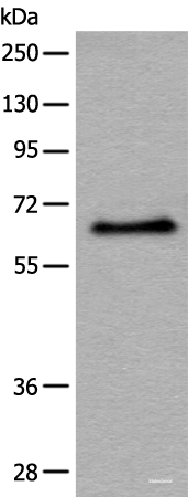 Western blot analysis of Hela cell lysate using ATF7 Polyclonal Antibody at dilution of 1:500
