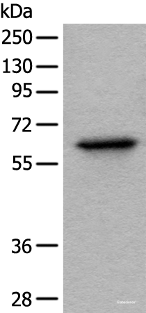 Western blot analysis of Hela cell lysate using BAIAP2L1 Polyclonal Antibody at dilution of 1:1000