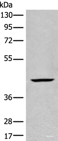 Western blot analysis of Human kidney tissue lysate using BBOX1 Polyclonal Antibody at dilution of 1:650
