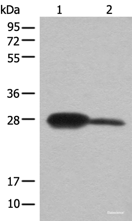 Western blot analysis of Mouse kidney tissue and A172 cell lysates using BDH2 Polyclonal Antibody at dilution of 1:600